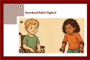 serebral-palsi-tipleri